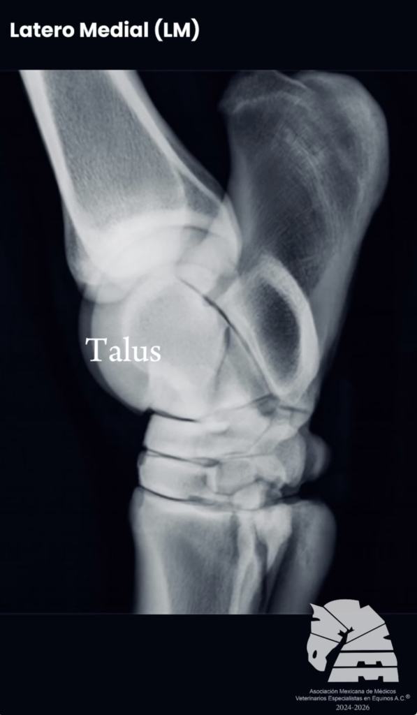 Toma radiográfica del tarso latero- medial